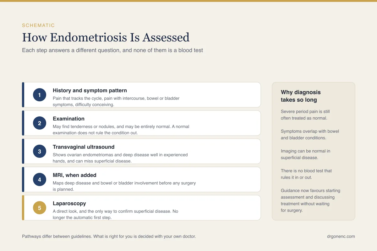 Endometriosis diagnosis: how the condition is tested and confirmed