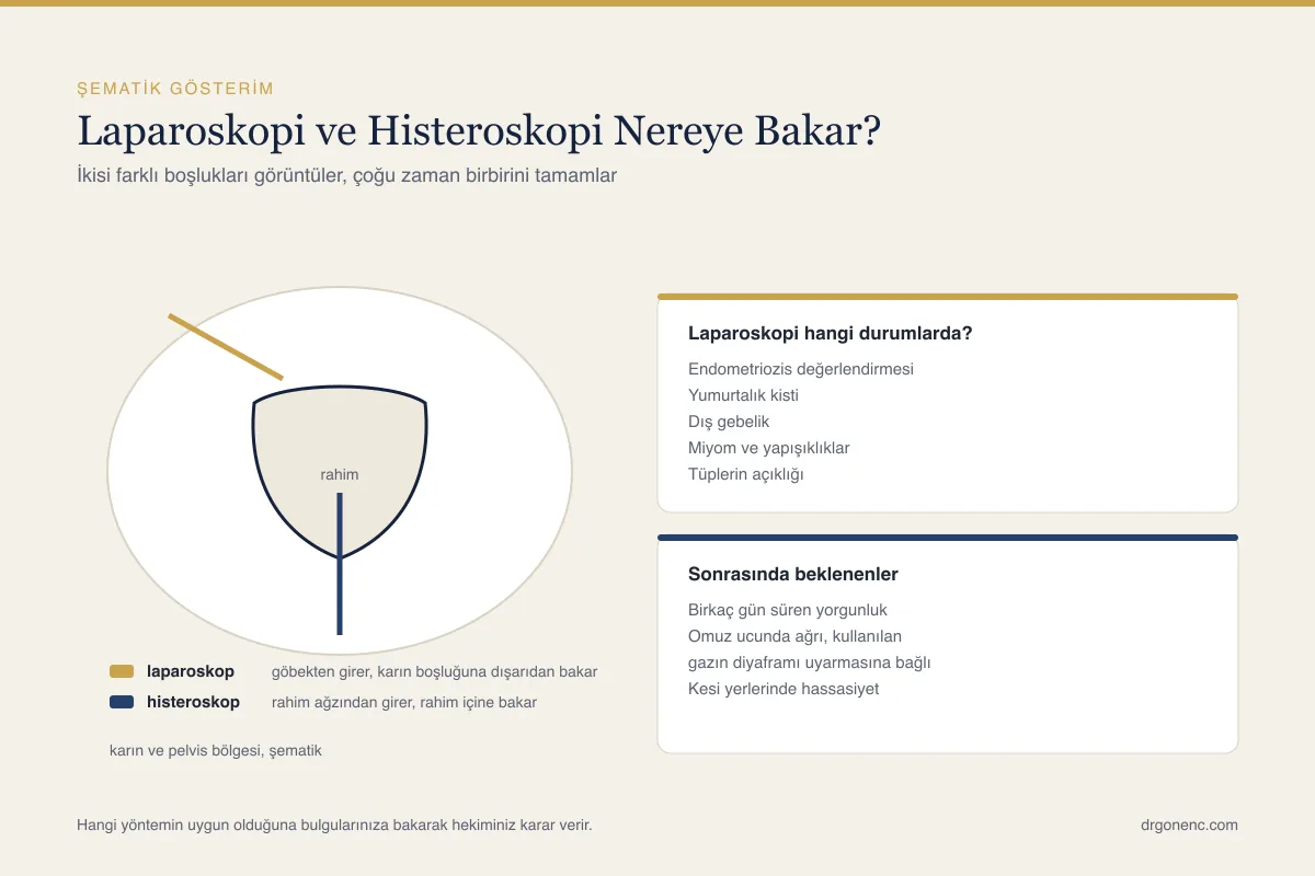 Laparoskopi nedir ve jinekolojide ne zaman yapılır?