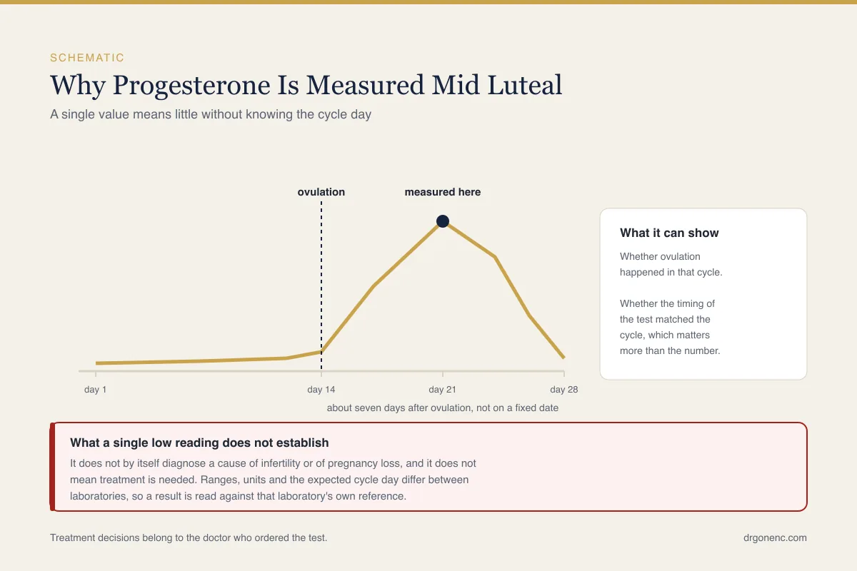 Low progesterone symptoms and causes: how a result is actually read