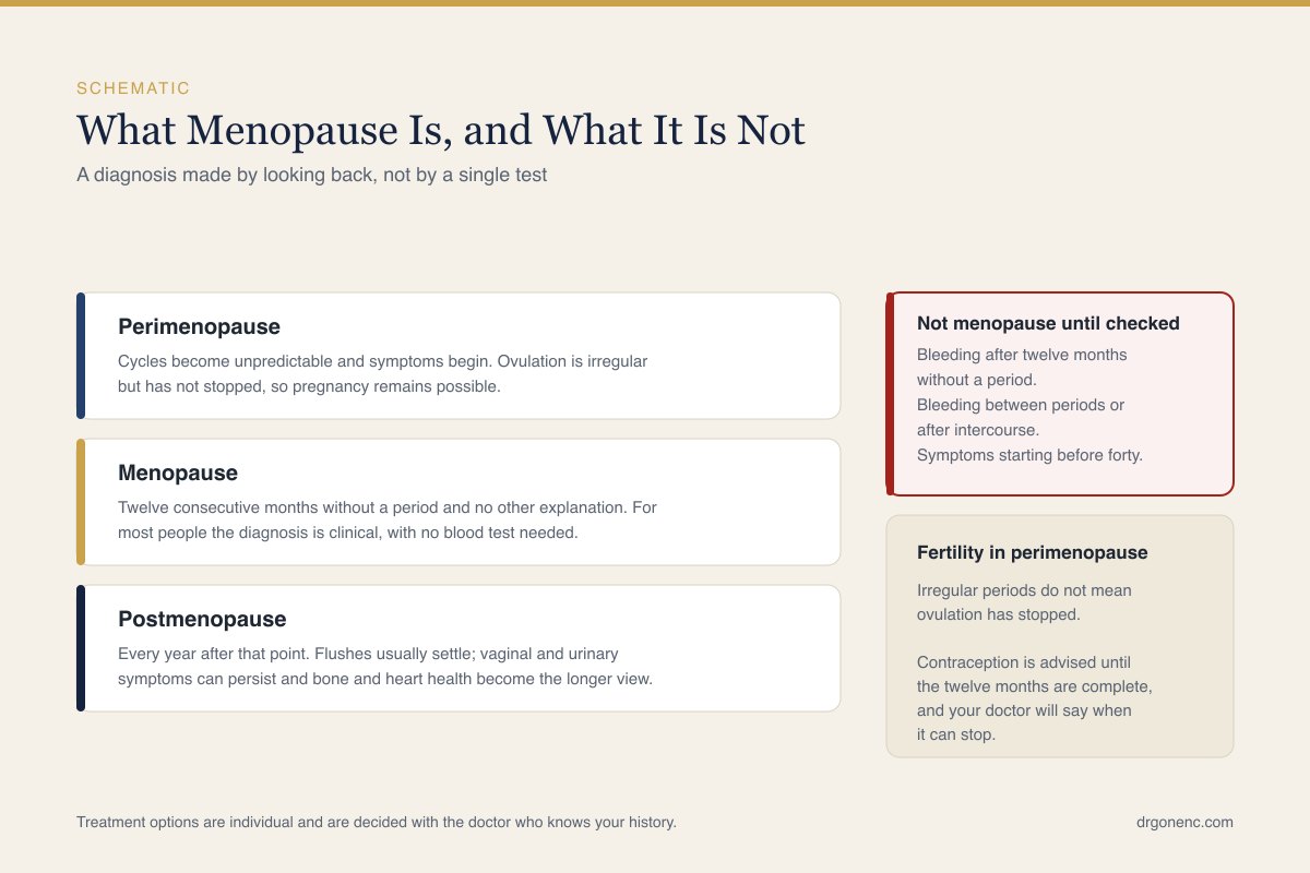 Schematic timeline diagram of the stages of menopause, showing in simple outline how one stage follows another