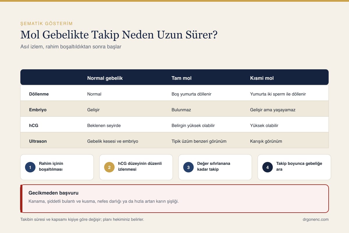 Mol gebelikte plasenta dokusunun rahim içindeki gelişimini anlatan şematik çizim