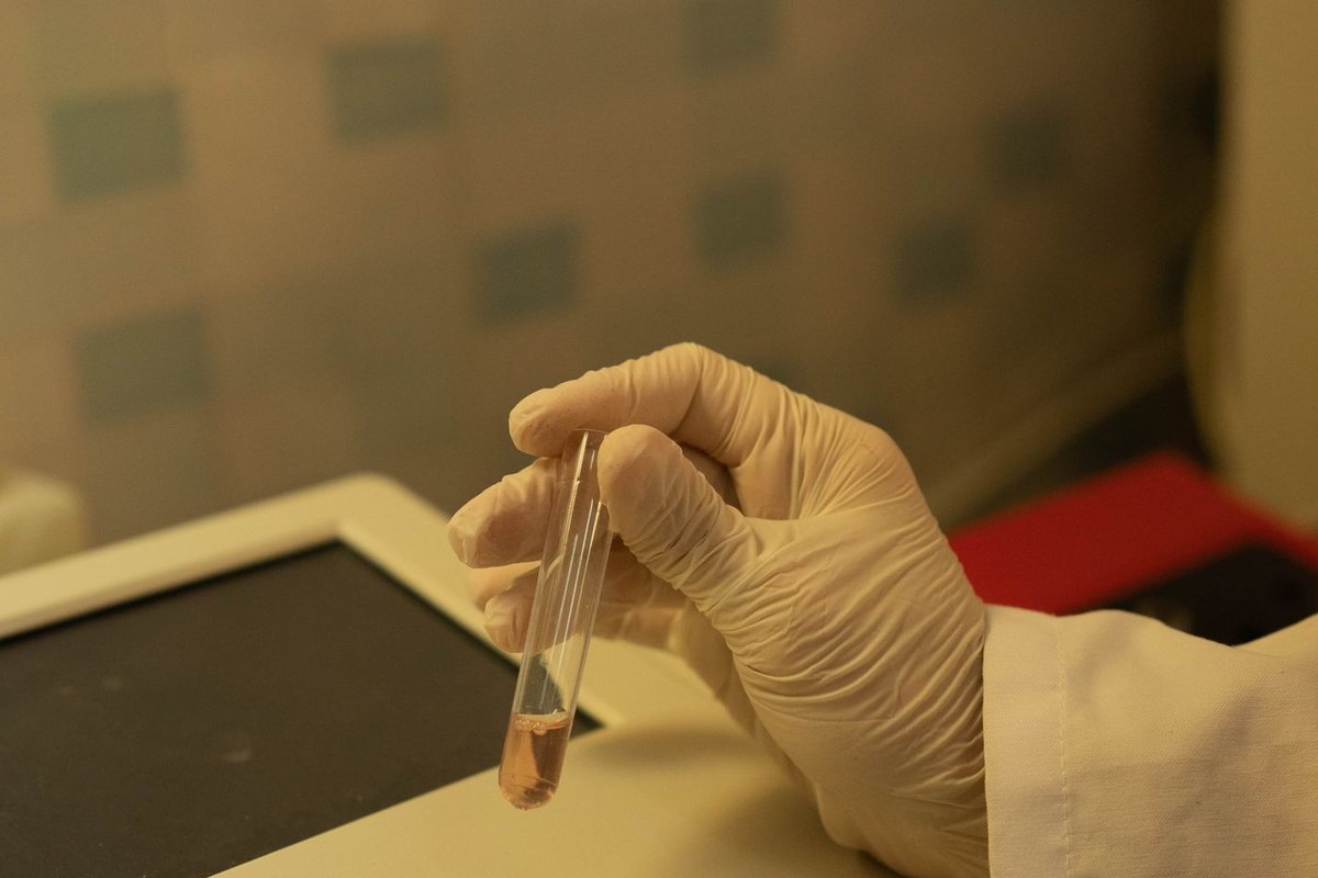 PGT (Preimplantasyon Genetik Test) Nedir?