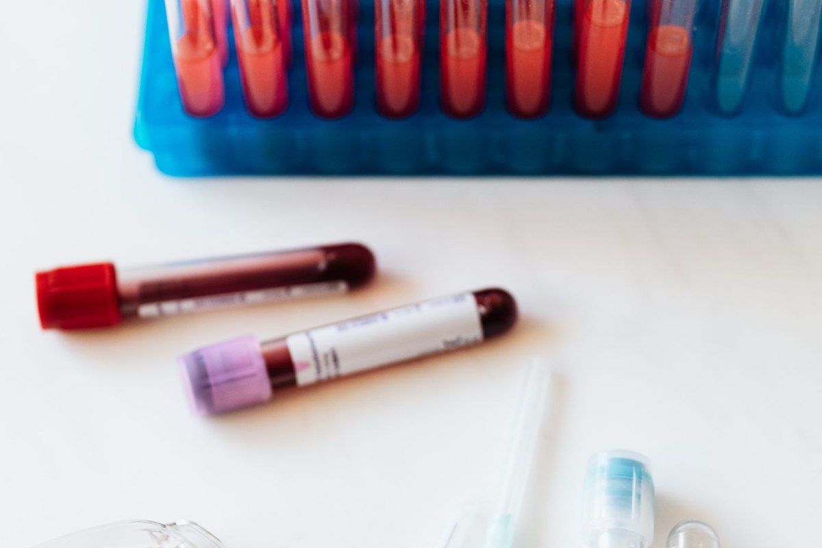 Healthy lifestyle concept for improving sperm count and quality