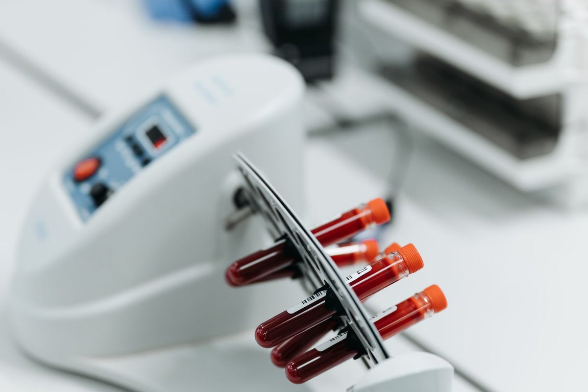 Semen Analysis Results Explained