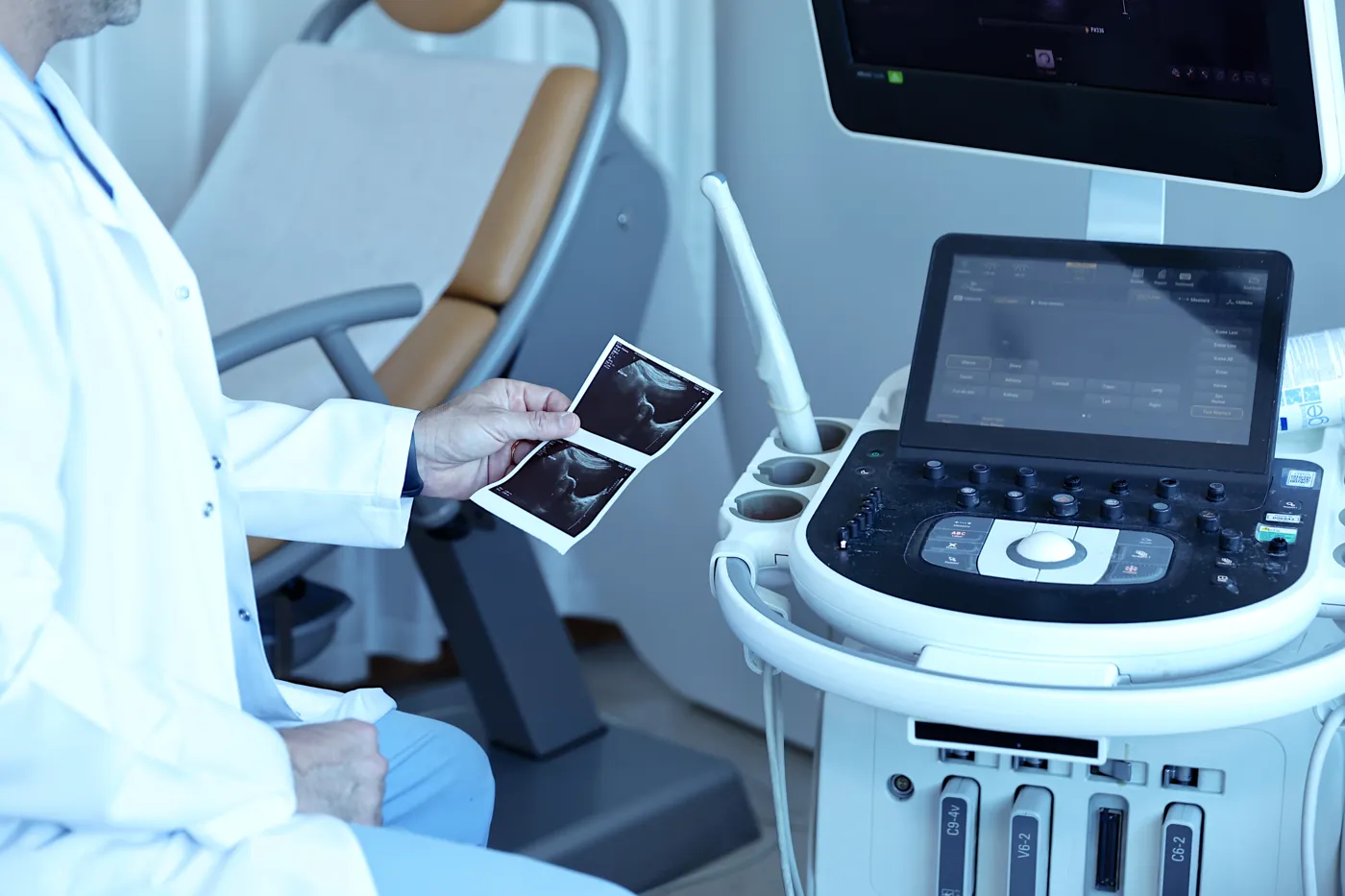Ovarian monitoring by ultrasound during IVF treatment